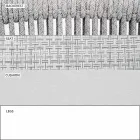 Garden Rocking Armchair Massiver und gepolsterter Stoff - Smart von Varaschin Viadurini