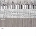 Garden Lounge Sessel Polsterstoff und Aluminium - Smart von Varaschin Viadurini